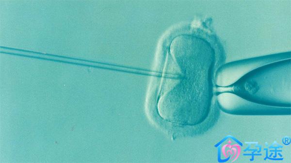 做三代试管婴儿备孕前男性需要吃什么调理精子